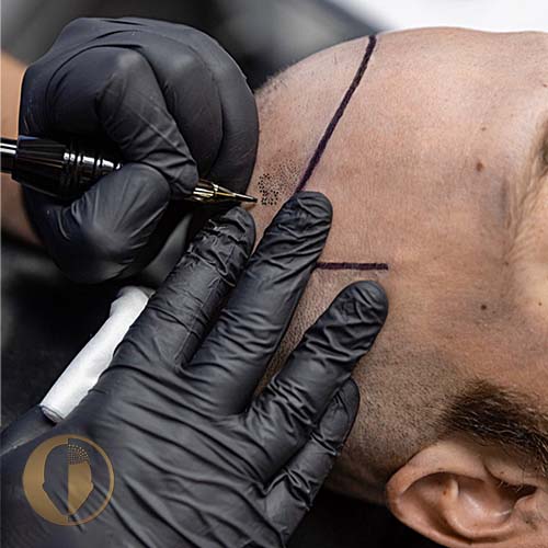 Justin drawing a hairline on a client