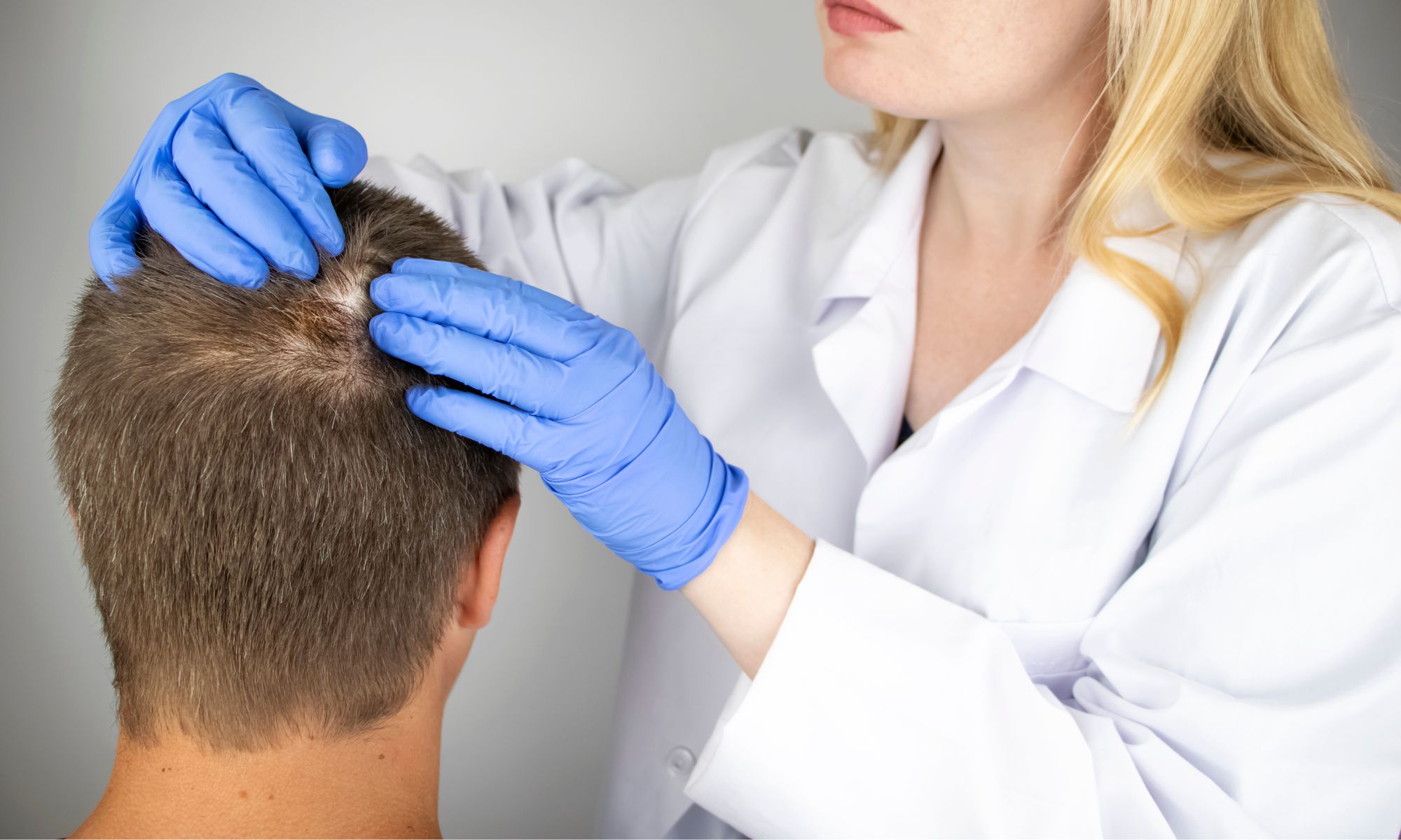 Restoring Hair and Confidence