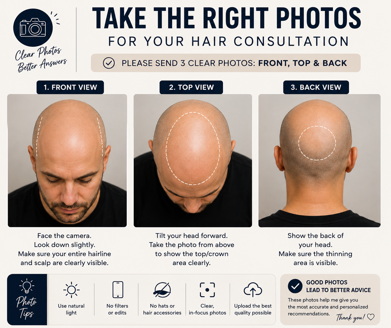 How to take the right photos for your scalp micropigmentation consultation: front, top, and back views with photo tips.