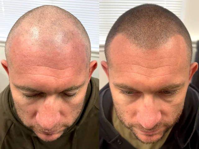 Before & After
