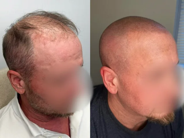 Before & After