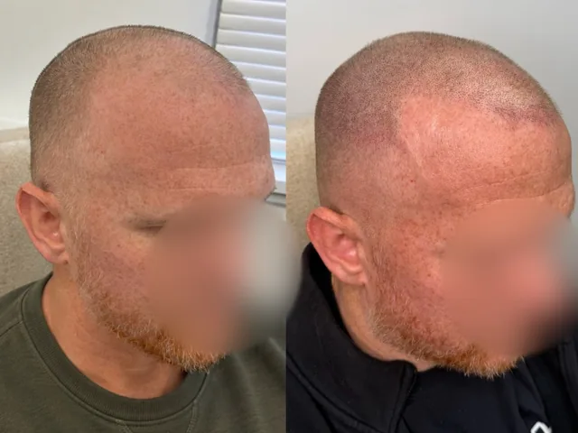 Before & After
