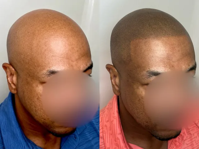 Before & After