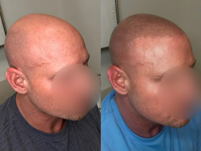 Before & After