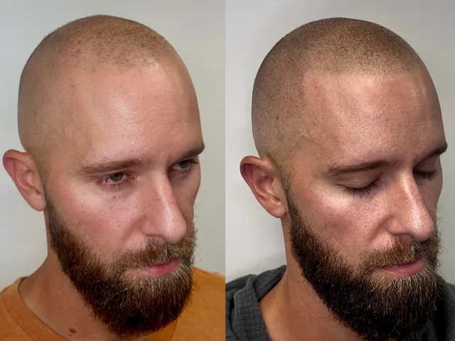 Before & After