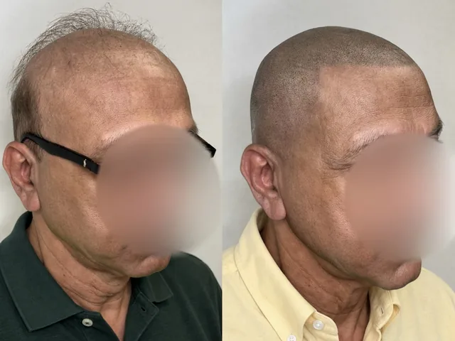 Before & After