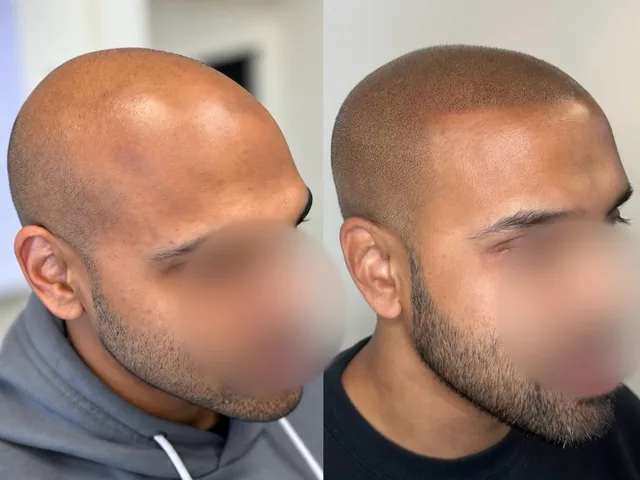 Before & After