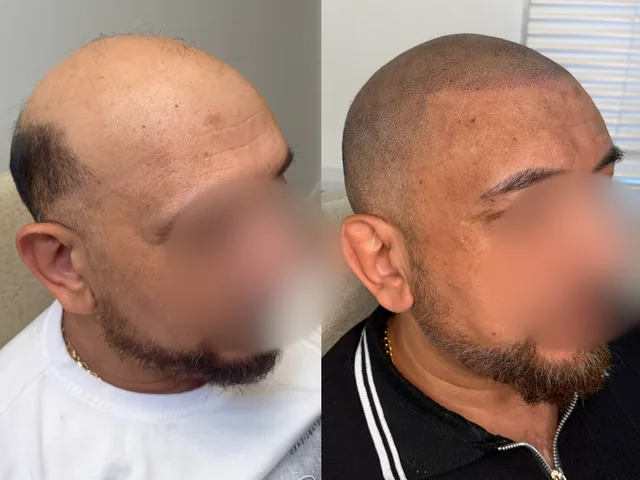 Before & After