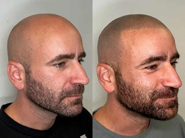 Before & After