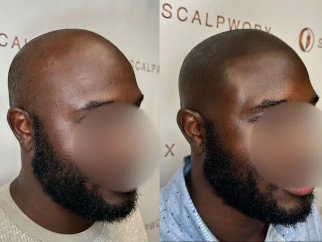 Before & After