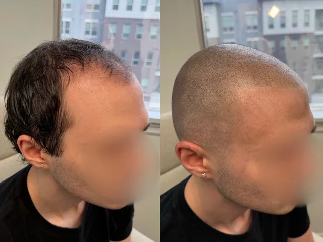 Before & After