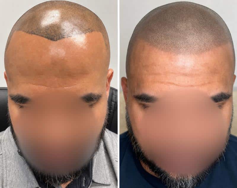 SMP Repair & Corrections