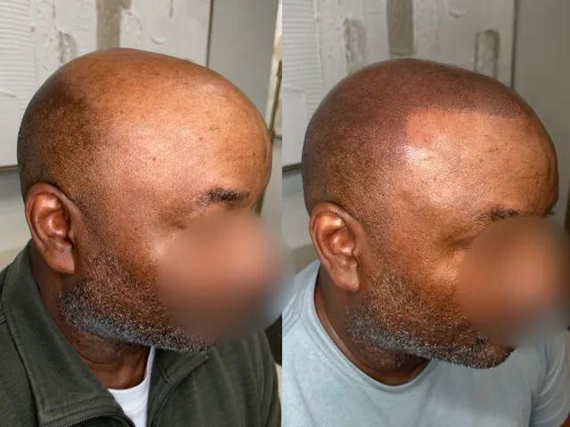 Before & After